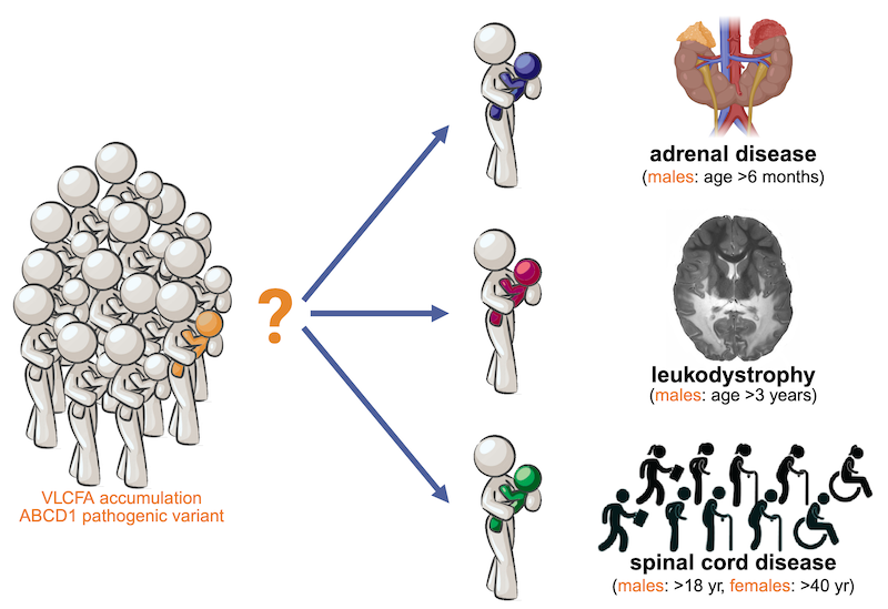 The ALD clinical spectrum. At the molecular level, ALD patients share a genetic defect in the ABCD1 gene
and elevated levels of VLCFA. ALD can be diagnosed at birth, but the clinical course cannot be predicted. Patients are
pre-symptomatic at birth. In males, adrenal insufficiency is often the first symptom to appear which can be as early as six
months of age. Cerebral ALD in male patients can occur at any age after three years of age. In adulthood, males and females
typically develop a slowly progressive myelopathy. Male patients with myelopathy are at risk of additionally developing
cerebral ALD.
