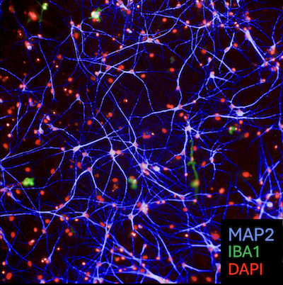 Microglia stained with MAP2, IBA1 and DAPI antibodies for ALD brain immune cell research